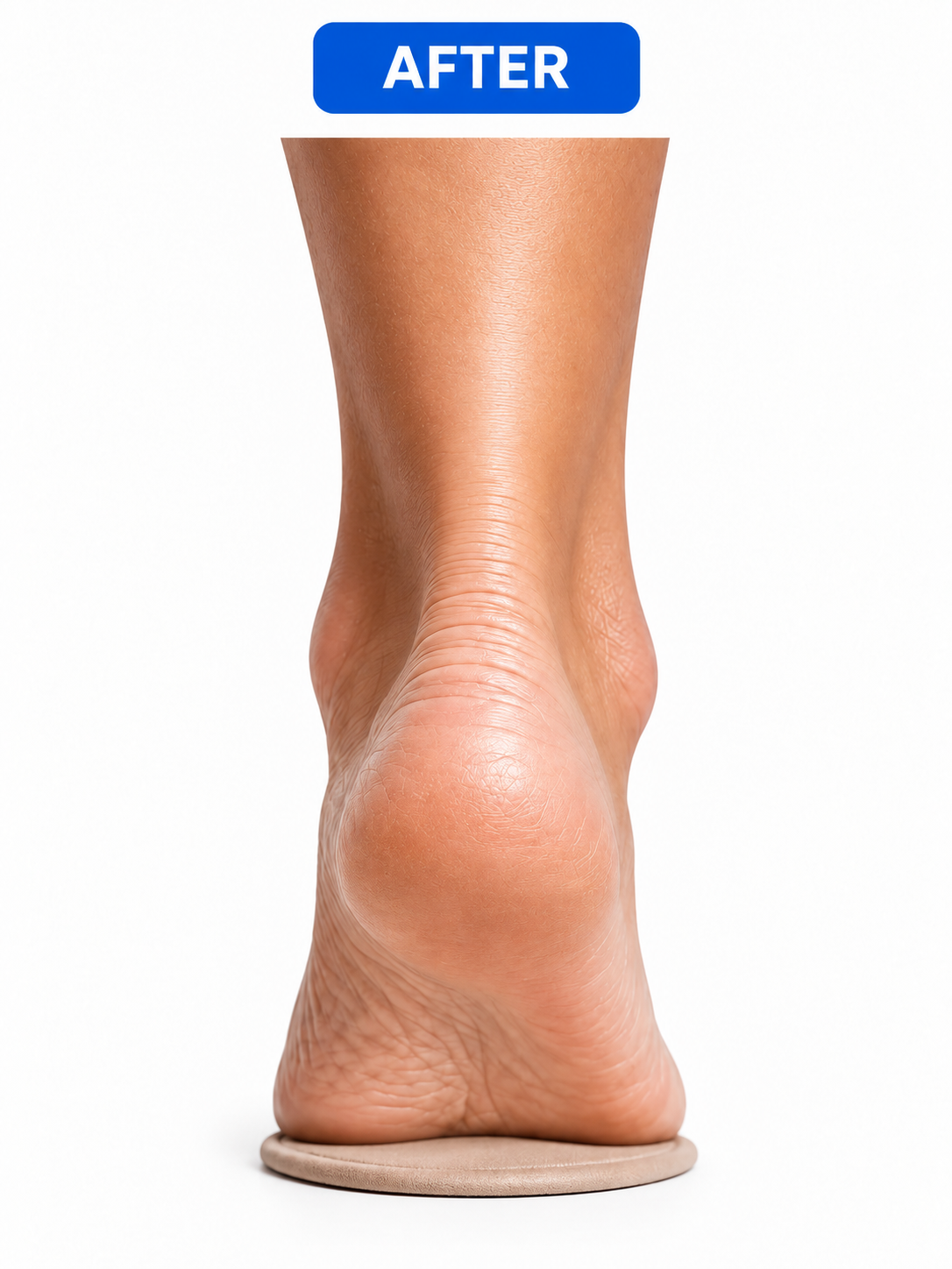 Illustration of a heel resting on soft cushioning