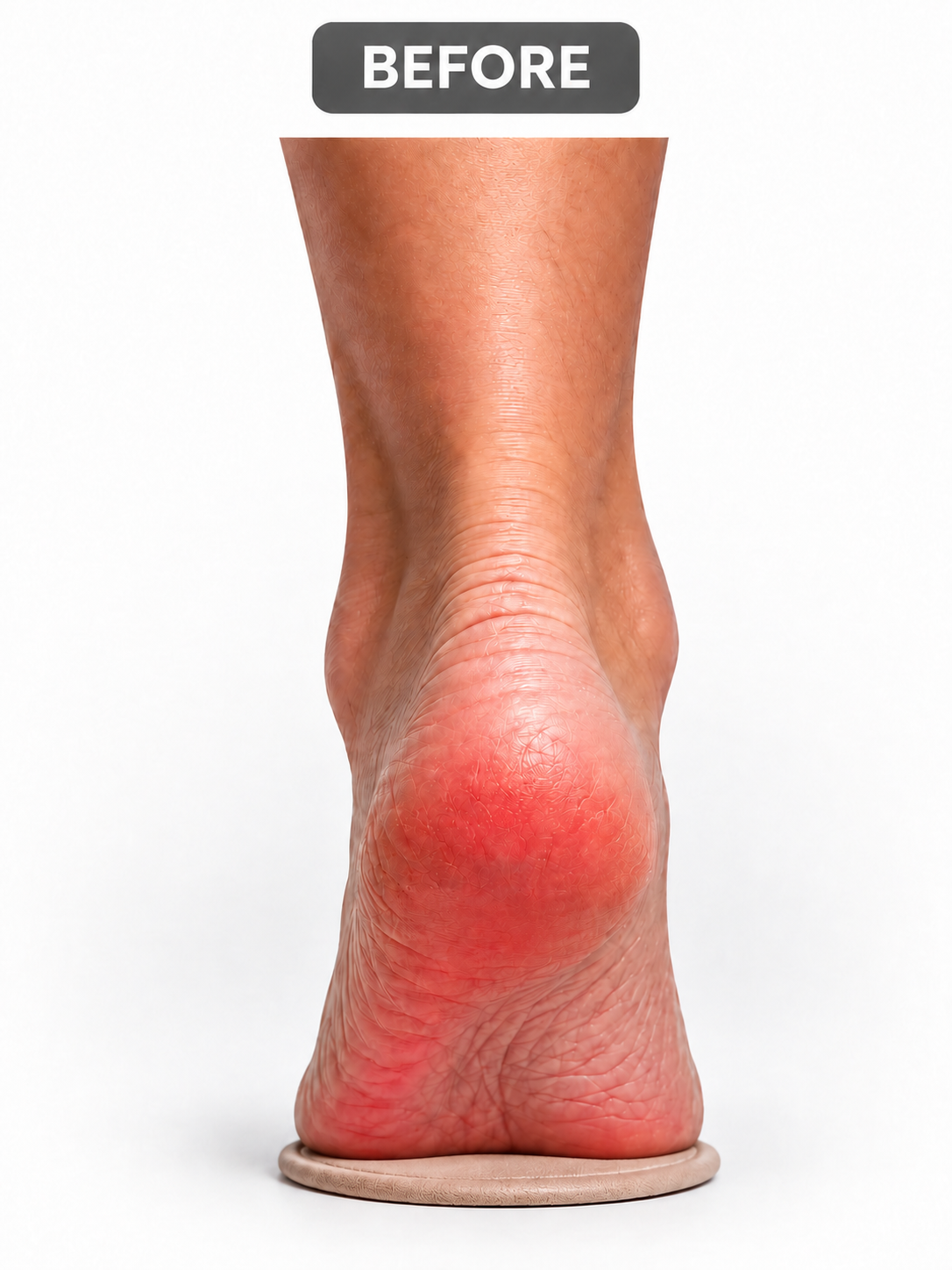 Illustration of heel discomfort